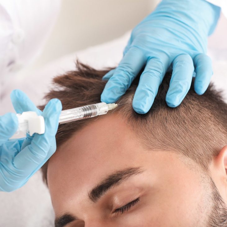 Mésothérapie des cheveux : micro-injections vitaminées - ESTHE-TIME