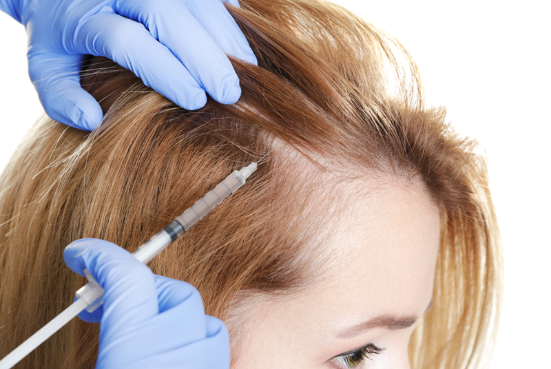 Mésothérapie des cheveux microinjections vitaminées ESTHETIME